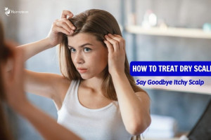 How to Treat Dry Scalp - Say Goodbye Itchy Scalp